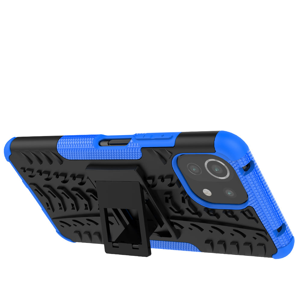 Xiaomi Mi 11 Lite 5G Case