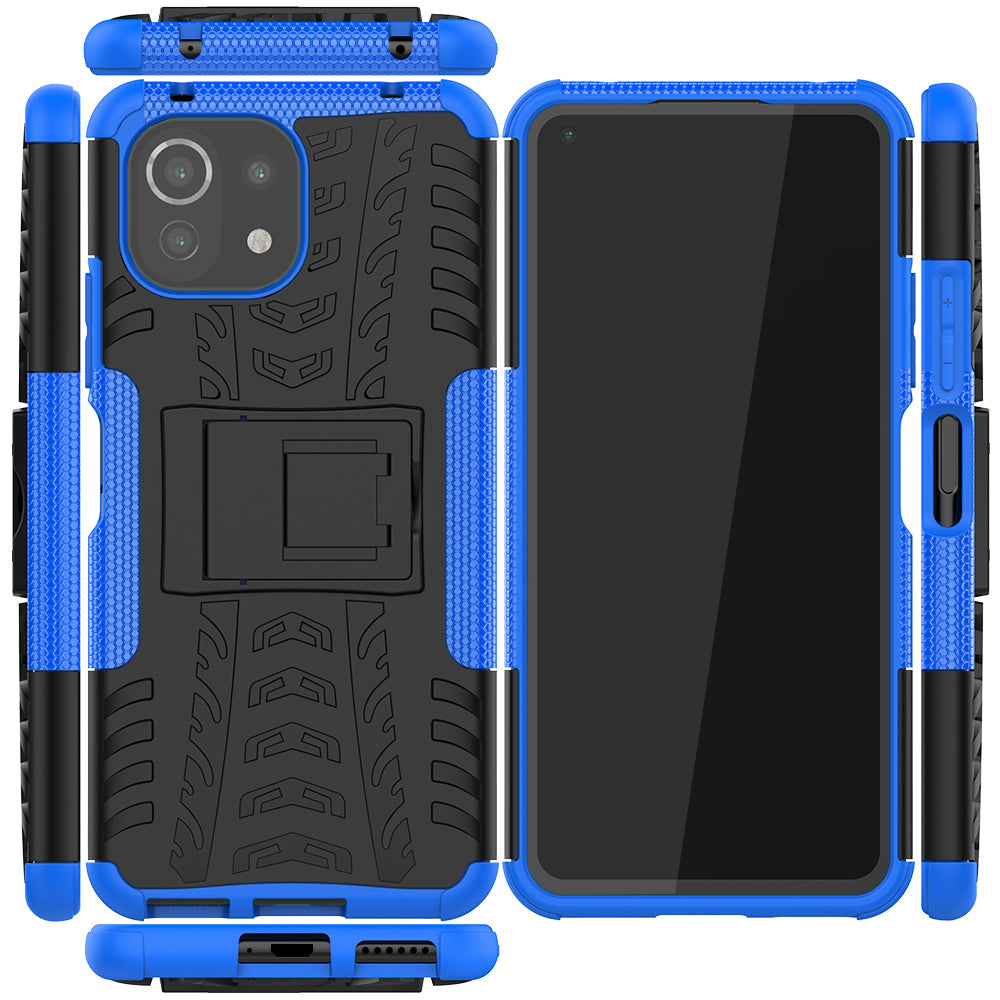 Xiaomi Mi 11 Lite 5G Case