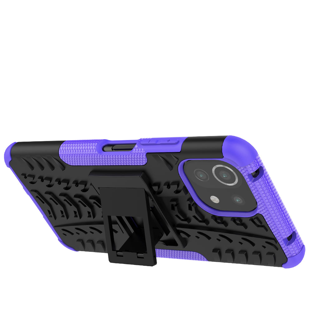 Xiaomi Mi 11 Lite 5G Case