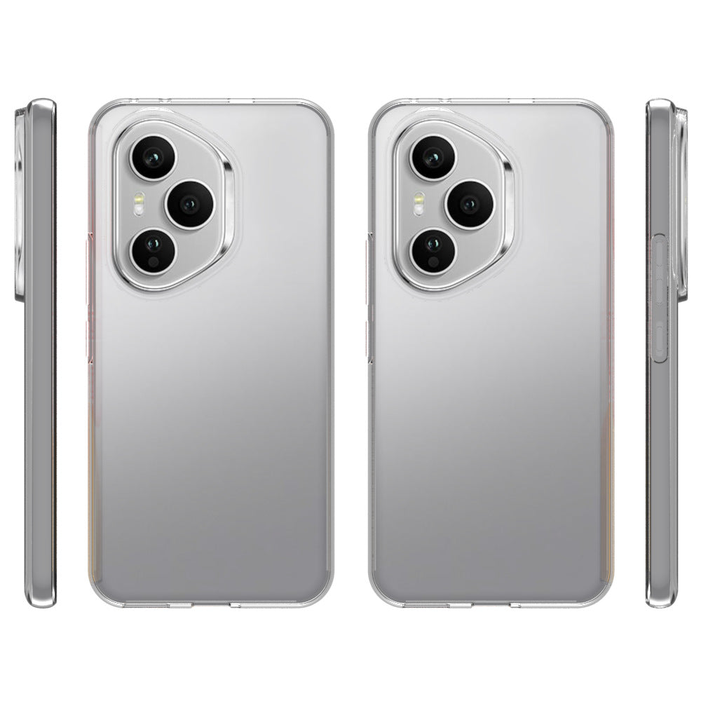 Honor 400 Pro Soft Gel Case - Slim Design