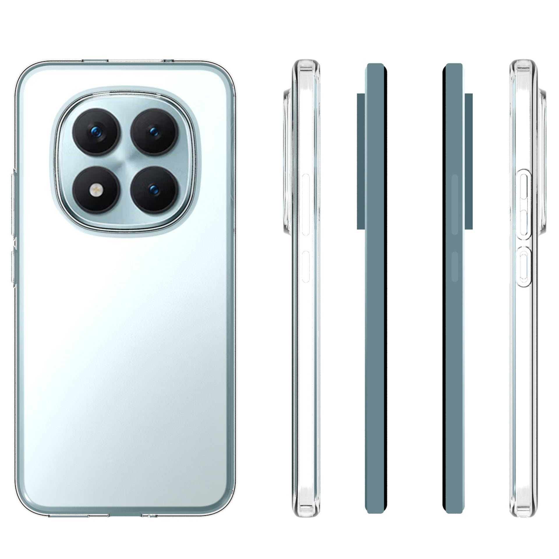 Redmi Note 15 Pro Plus 5G Soft Gel Case - Slim Design