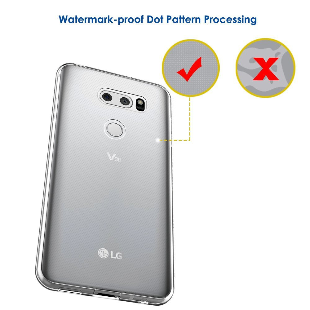 LG V30+ Case